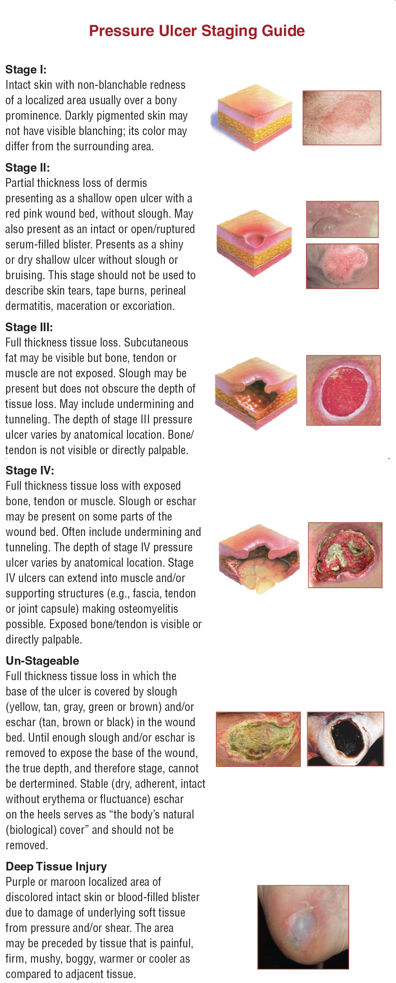 Pressure Ulcer Sites Diagram